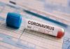Covid-19: El gobierno español compra 650.000 test defectuosos