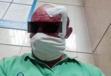 Denunciamos y repudiamos brutales agresiones fascistas contra el músico Javier Cuesta y un sindicalista de UGT